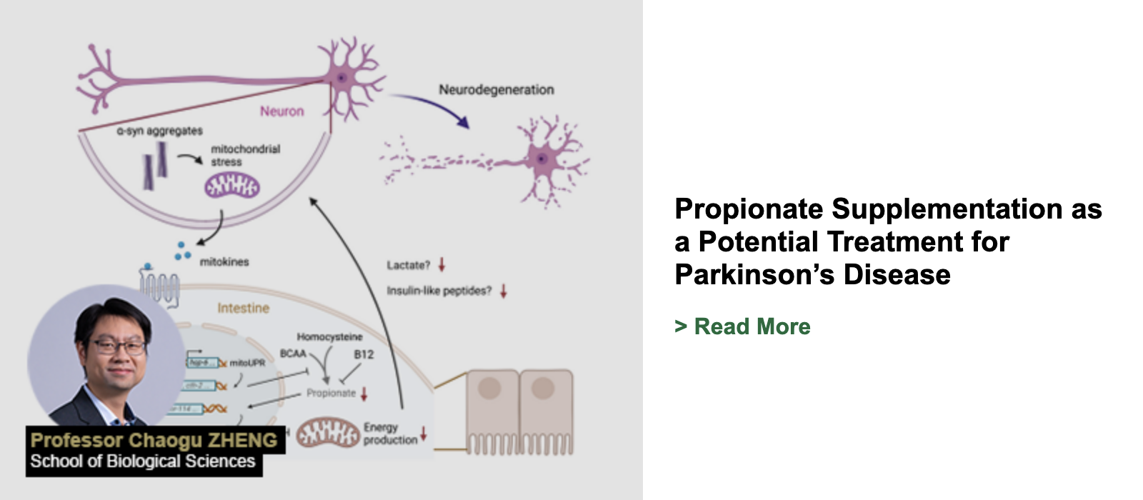 Propionate Supplementation as a Potential Treatment for Parkinson’s Disease